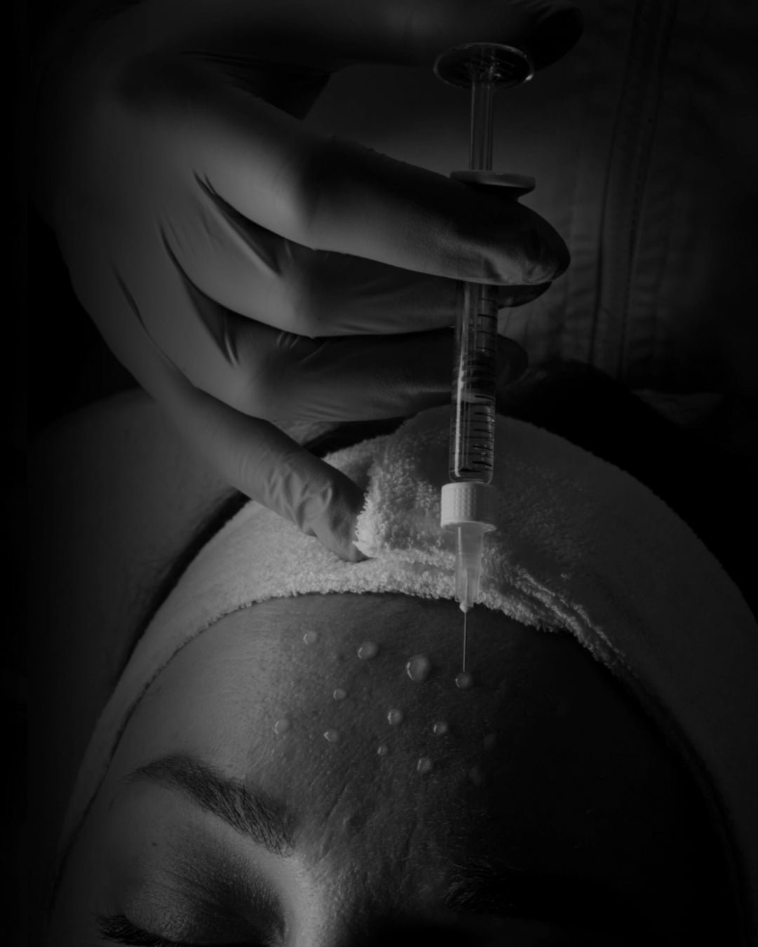 What’s Trending in Aesthetics: PDGF, PRP, PRF & PRF EZ Gel