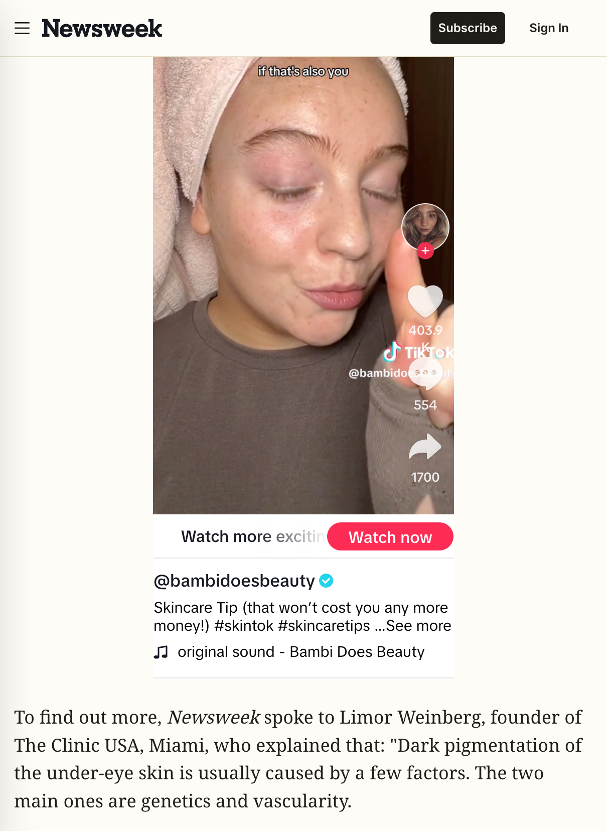 Skincare Hack for Tackling Dark Circles Without Spending a Penny Goes Viral